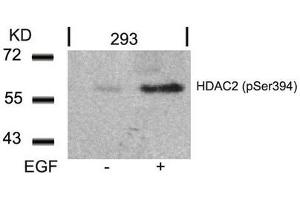Western blot analysis of extracts from 293 cells untreated or treated with EGF using HDAC2(Phospho-Ser394) Antibody.
