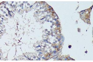 Immunohistochemistry of paraffin-embedded Mouse testis using SLC7A2 Polyclonal Antibody at dilution of 1:100 (40x lens). (SLC7A2 Antikörper)