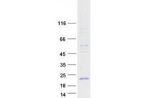 Western Blotting (WB) image for Phospholipase A2, Group IB (PLA2G1B) protein (Myc-DYKDDDDK Tag) (ABIN2729073)