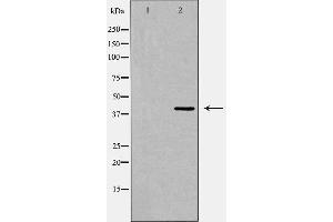 Western blot analysis of PRLHR expression in Jurkat cell extract,The lane on the left is treated with the antigen-specific peptide. (PRLHR Antikörper  (Internal Region))