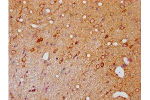 IHC image of ABIN7127722 diluted at 1:100 and staining in paraffin-embedded rat brain tissue performed on a Leica BondTM system. (Rekombinanter PAK1 Antikörper  (pSer139, pSer141, pSer144))