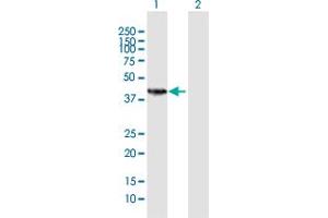 Western Blot analysis of HSD11B2 expression in transfected 293T cell line by HSD11B2 MaxPab polyclonal antibody. (HSD11B2 Antikörper  (AA 1-405))