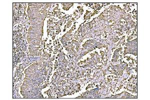 IHC analysis of HCCS using anti-HCCS antibody (ABIN7602424). (HCCS Antikörper  (AA 76-268))
