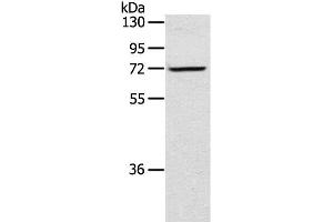 Western Blot analysis of TM4 cell using LTA4H Polyclonal Antibody at dilution of 1:300 (LTA4H Antikörper)