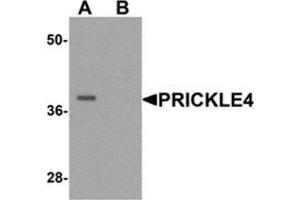 Western blot analysis of PRICKLE4 in A549 cell lysate with PRICKLE4 Antibody  at 0. (PRICKLE4 Antikörper  (N-Term))