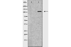Western blot analysis of NCI-H460  lysate using TLR8 antibody. (TLR8 Antikörper  (C-Term))