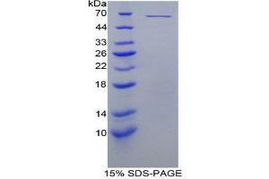 SDS-PAGE (SDS) image for Perforin 1 (Pore Forming Protein) (PRF1) (AA 40-355) protein (His tag,GST tag) (ABIN2123450)