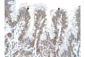 RSRC2 antibody was used for immunohistochemistry at a concentration of 4-8 ug/ml to stain Epithelial cells of fundic gland (arrows) in Human Stomach. (RSRC2 Antikörper  (C-Term))