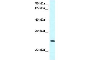 WB Suggested Anti-WWOX Antibody Titration: 1.