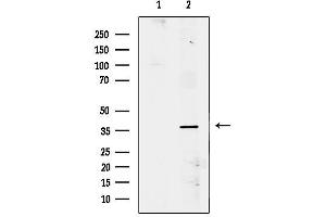 Western blot analysis of lysates from COLO, using SIAH2 Antibody.