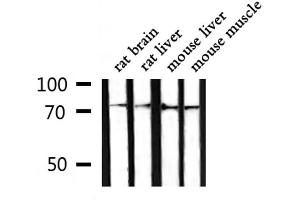 Western blot analysis of extracts from rat brain ,rat liver,mouse liver,mouse muscle, using GARS Antibody. (GARS Antikörper  (C-Term))