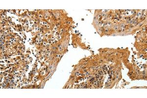 Immunohistochemistry of paraffin-embedded Human tonsil tissue using TNR Polyclonal Antibody at dilution 1:60 (Tenascin R Antikörper)