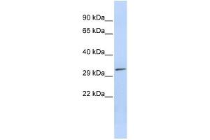 WB Suggested Anti-PDXP Antibody Titration: 0. (PDXP Antikörper  (Middle Region))
