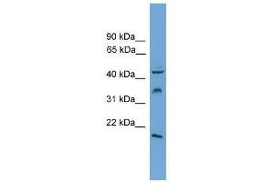 DUSP5 antibody used at 0. (DUSP5 Antikörper  (Middle Region))