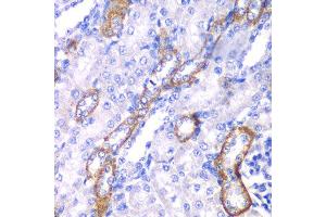 Immunohistochemistry of paraffin-embedded rat kidney using MYO1C antibody at dilution of 1:100 (x40 lens). (Myosin IC Antikörper)