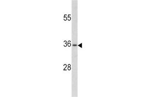 Western Blotting (WB) image for anti-Paired Box 4 (PAX4) antibody (ABIN3002750)