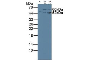 Western blot analysis of (1) Human 293T Cells, (2) Human HeLa cells and (3) Human HepG2 Cells. (CS Antikörper  (AA 103-394))