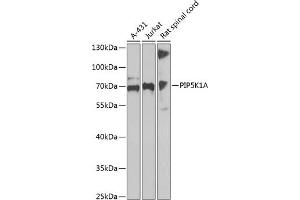 Western blot analysis of extracts of various cell lines, using PIP5K1A antibody  at 1:1000 dilution. (PIP5K1A Antikörper  (AA 231-500))