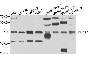 Western blot analysis of extracts of various cell lines, using BCAT2 antibody. (BCAT2 Antikörper)