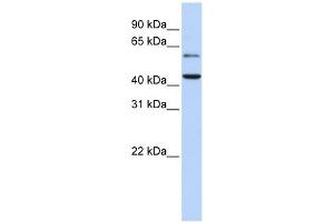 CMAS antibody used at 1 ug/ml to detect target protein. (CMAS Antikörper  (N-Term))