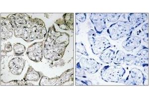 Immunohistochemistry analysis of paraffin-embedded human placenta tissue, using ME2 Antibody. (NAD-ME Antikörper  (AA 201-250))