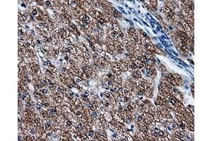 Immunohistochemical staining of paraffin-embedded liver tissue using anti-FAHD2Amouse monoclonal antibody. (FAHD2A Antikörper)