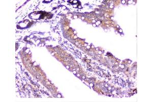 IHC analysis of cortactin using anti-cortactin antibody (ABIN6719306).
