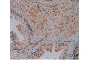 IHC-P analysis of Human Prostate Gland Tissue, with DAB staining. (Corin Antikörper  (AA 134-573))