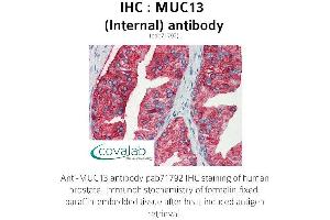 Image no. 1 for anti-Mucin 13, Cell Surface Associated (MUC13) (Internal Region) antibody (ABIN1737140)