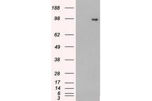 Image no. 14 for anti-TYRO3 Protein Tyrosine Kinase (TYRO3) antibody (ABIN1501606) (TYRO3 Antikörper)