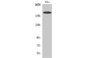 Western Blotting (WB) image for anti-Collagen, Type V, alpha 1 (COL5A1) (Internal Region) antibody (ABIN6282726)