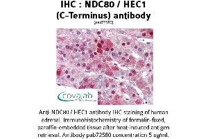 Image no. 1 for anti-NDC80 Kinetochore Complex Component Homolog (NDC80) (C-Term) antibody (ABIN1737233) (NDC80 Antikörper  (C-Term))