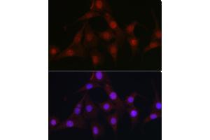 Immunofluorescence analysis of NIH/3T3 cells using C9orf72 Rabbit pAb (ABIN7266391) at dilution of 1:100 (40x lens).