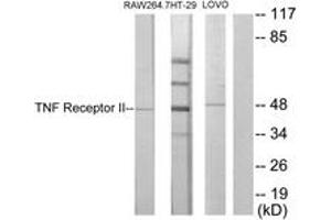 Western blot analysis of extracts from RAW264. (TNFRSF1B Antikörper  (AA 376-425))