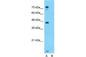 Host:  Rabbit  Target Name:  EPX  Sample Type:  MCF7  Lane A:  Primary Antibody  Lane B:  Primary Antibody + Blocking Peptide  Primary Antibody Concentration:  1ug/ml  Peptide Concentration:  5ug/ml  Lysate Quantity:  25ug/lane/lane  Gel Concentration:  0. (EPX Antikörper  (Middle Region))