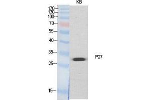 Western Blot (WB) analysis of specific cells using p27 Polyclonal Antibody. (P27 (Ser235), (Ser236) Antikörper)