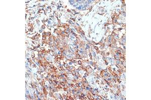 Immunohistochemistry (IHC) image for anti-phospholipid Scramblase 1 (PLSCR1) antibody (ABIN7269354)
