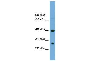 WB Suggested Anti-TREML2 Antibody Titration:  0. (TREML2 Antikörper  (N-Term))
