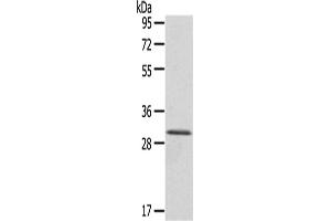 Western Blotting (WB) image for anti-HIV-1 Tat Interactive Protein 2, 30kDa (HTATIP2) antibody (ABIN5956861) (HIV-1 Tat Interactive Protein 2, 30kDa (HTATIP2) Antikörper)