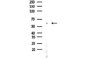 anti-Bardet-Biedl Syndrome 9 (BBS9) (C-Term) antibody