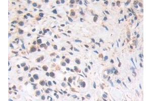 Immunohistochemistry (IHC) image for anti-Helicase-Like Transcription Factor (HLTF) (AA 837-996) antibody (ABIN7443560)