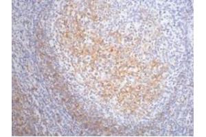 IHC staining of Human tonsil tissue paraffin-embedded, diluted at 1:200. (FCER2 Antikörper)