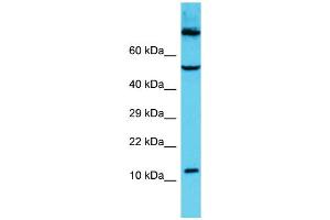 Host: Rabbit Target Name: C9orf16 Sample Type: HCT15 Whole Cell lysates Antibody Dilution: 1. (C9orf16 Antikörper  (Middle Region))