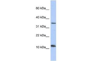 WB Suggested Anti-NXNL2 Antibody Titration: 0. (NXNL2 Antikörper  (Middle Region))