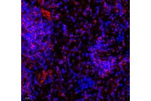 Immunofluorescence (Paraffin-embedded Sections) (IF (p)) image for anti-La Ribonucleoprotein Domain Family, Member 1 (LARP1) antibody (ABIN7074453)