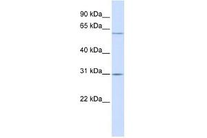 TMEM106C antibody used at 1 ug/ml to detect target protein. (TMEM106C Antikörper  (Middle Region))