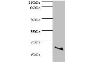 Western blot All lanes: ASF1A antibody at 2 μg/mL + Jurkat whole cell lysate Secondary Goat polyclonal to rabbit IgG at 1/10000 dilution Predicted band size: 23 kDa Observed band size: 23 kDa (ASF1A Antikörper  (AA 1-204))