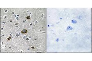 Immunohistochemistry analysis of paraffin-embedded human brain tissue, using AKAP1 Antibody. (AKAP1 Antikörper  (AA 281-330))