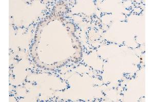 Immunohistochemistry (IHC) image for anti-Myc Proto-Oncogene protein (MYC) (pThr58) antibody (ABIN6256584)