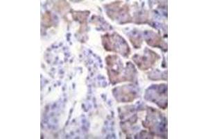 Formalin fixed and paraffin embedded human pancreas tissue stained with Carboxypeptidase B Antibody (N-term) followed by peroxidase conjugation of the secondary antibody and DAB staining.